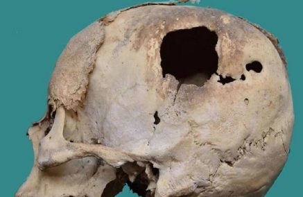Un cranio risalente al 1700 ritorna a Comiso