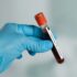 Ematologia e Talassemia all’ospedale “Giovanni Paolo II”